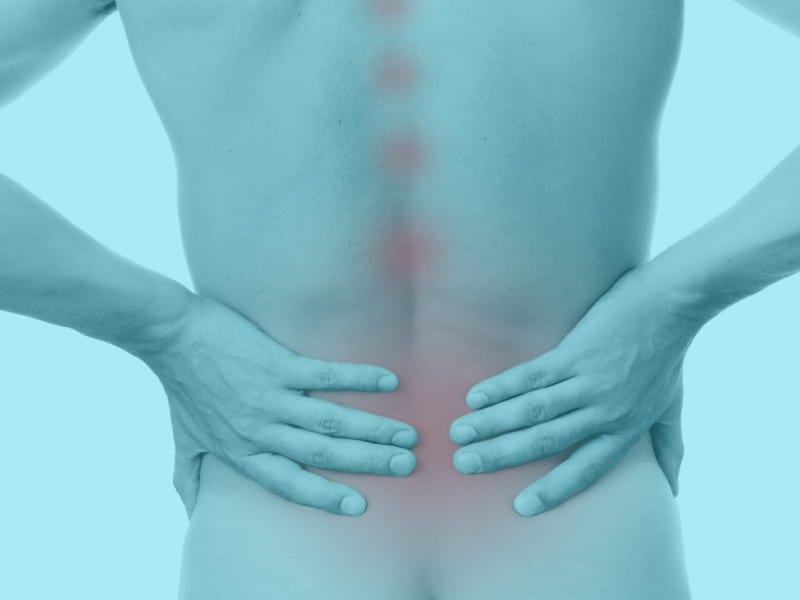 sciatica